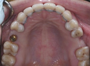 Контроль контактов и глубины перекрытия фото