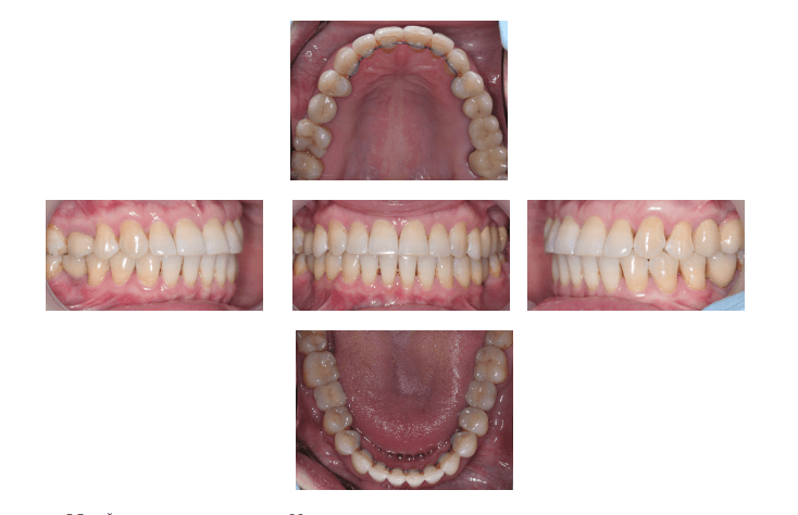 Установлены формирователей десны фото 2