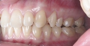 Дисфункция внчс лечение фото 3